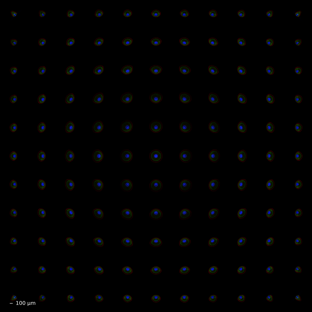 lens